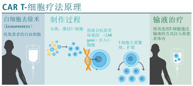 CAR T-細(xì)胞療法原理